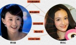 爆料明星整容是谁啊视频,视频爆料明星整容真相，究竟是谁在背后动刀？